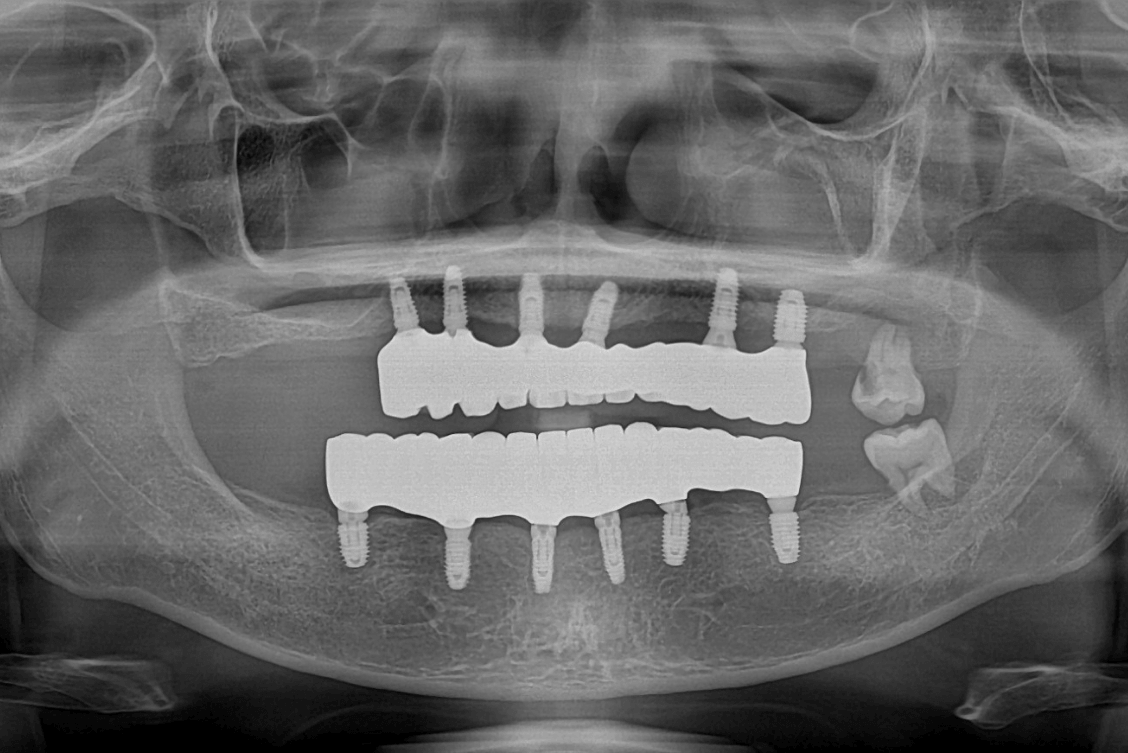 Dr Angela - goh haojie Xray (1)