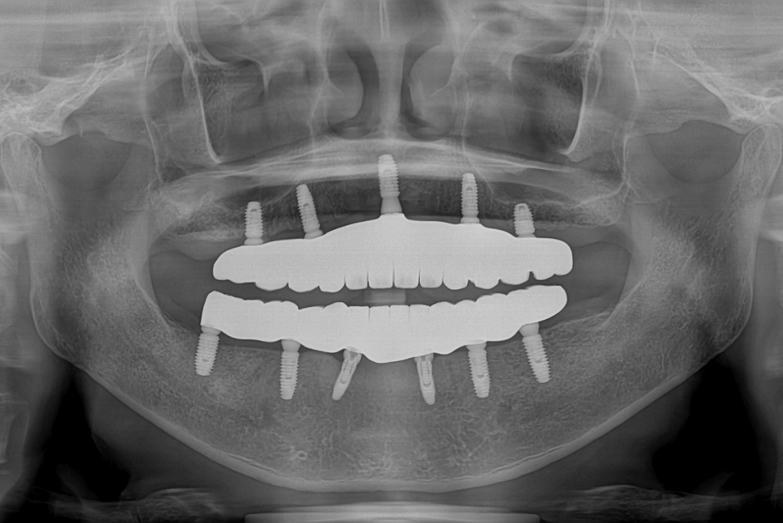 Dr. Angela - Bernard Xray (1)