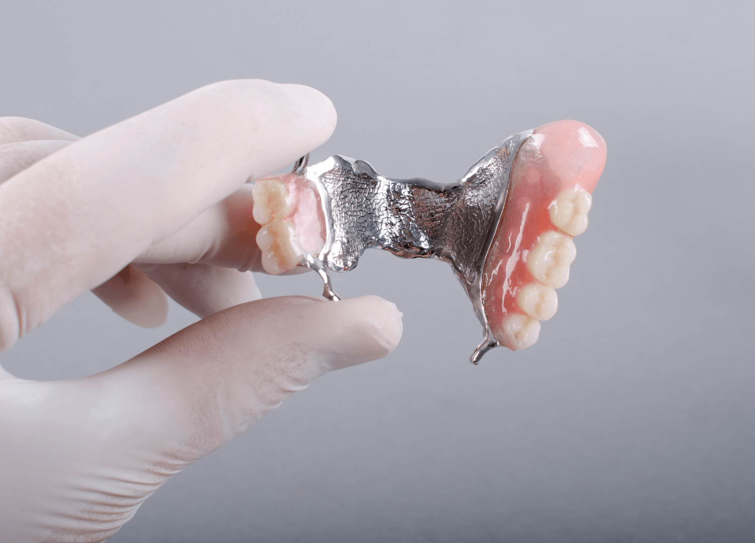 Cobalt chrome partial denture with metal framework and artificial teeth