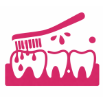 bleeding gums