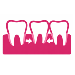 loose teeth